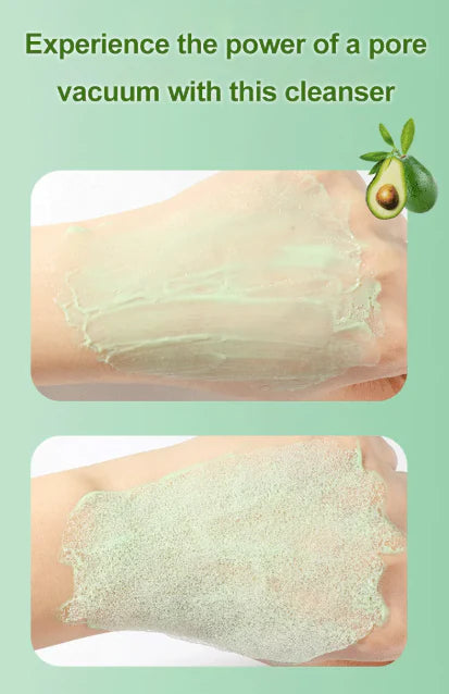 Last Day Of Discount 🔥 Bubble Clay Mask
